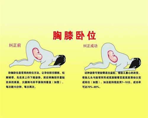 上海三代供卵试管婴儿_上海子宫肌瘤代孕_好孕无忧官网-56岁供卵现在做一次试