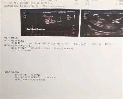 上海代孕哪里最好_上海找个代孕的_天赐宝贝助孕-换家医院CT检查重新做不合理